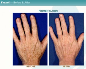 DermaCure Medical Professionals Discuss Top Holiday Treatments