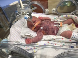 Hart High Grad, Wife Raise Funds For Baby With Cancer-2
