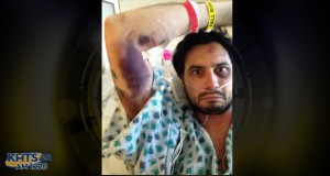 Image of Ian James Pike in his hospital bed; Pike posted the photo to his Facebook page and called it the “gnarliest bruise I’ve ever had.”
