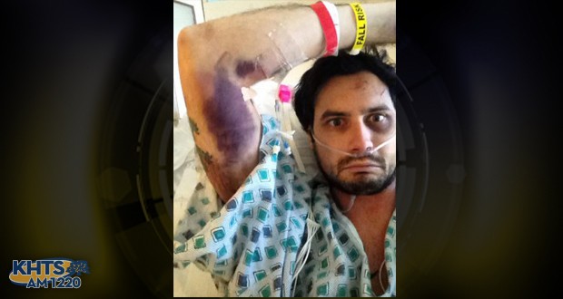 Image of Ian James Pike in his hospital bed; Pike posted the photo to his Facebook page and called it the “gnarliest bruise I’ve ever had.”