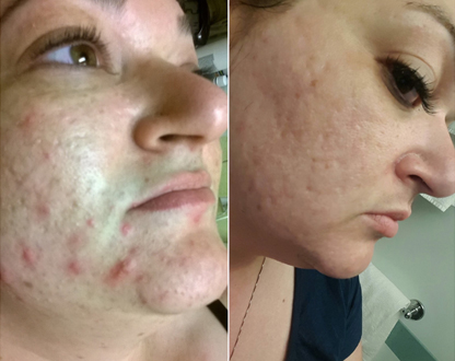 Luminesce Skin Care by Jeunesse Luminesce Skin Care by Jeunesse