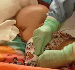 Baby Fighting Rare Brain Tumor Gets To Spend Week At Home, Starts Second Round Of Chemo