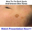 Dr. Gundry Darkspot125x125