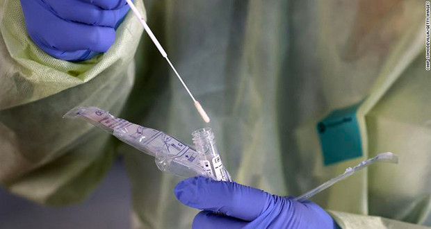 A COVID-19 swab test