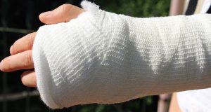 Arm in a cast