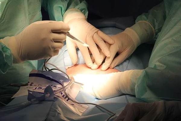 Operate