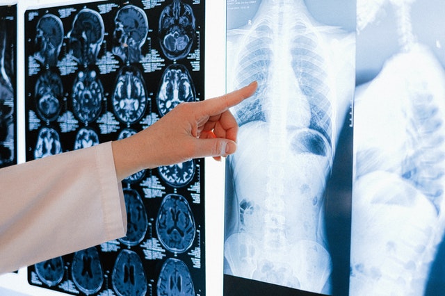 X-Rays