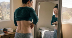 IMAGE ALT TEXT: Santa Clarita woman with recurring pain looking at her back surgery scar in the mirror.
